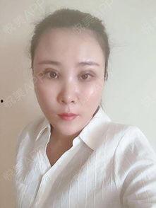 面部绷带明星推荐,揭秘隐藏在绷带之下的美丽传奇